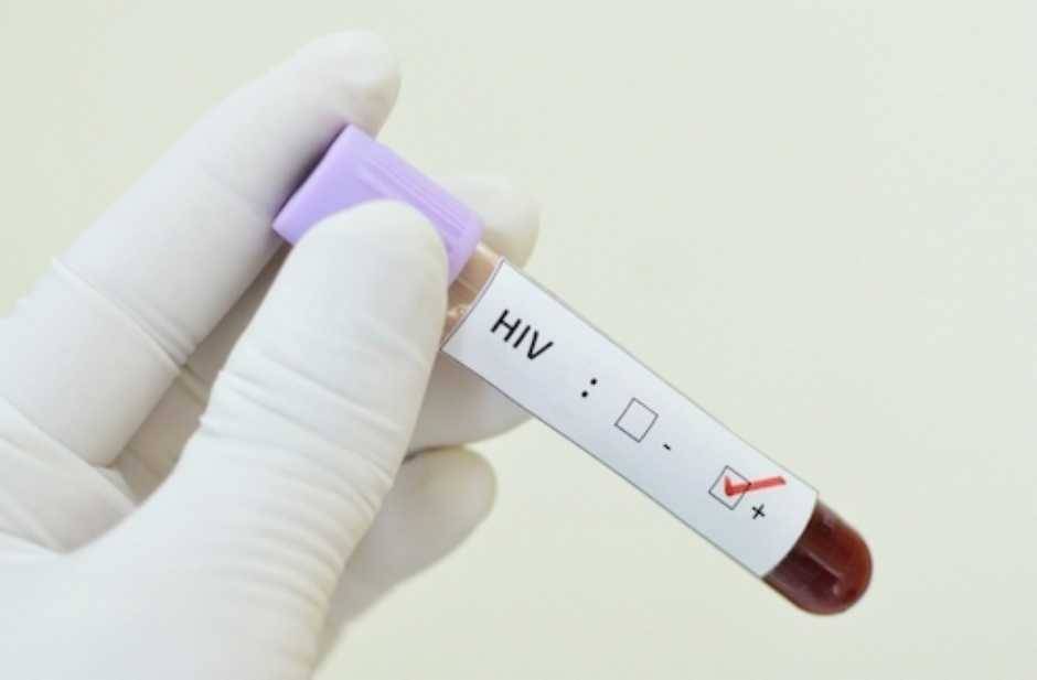 ONU alerta para aumento de infecções por HIV após cortes de verbas pelos EUA